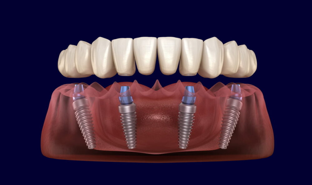 Bancroft Dentistry